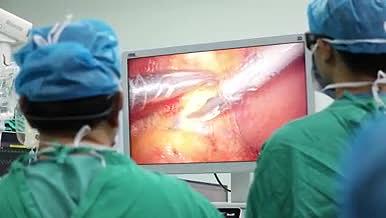 手术室3d腹腔镜下胃癌根治术视频的预览图